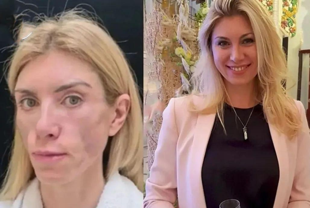 جراحی ملکه زیبایی روس