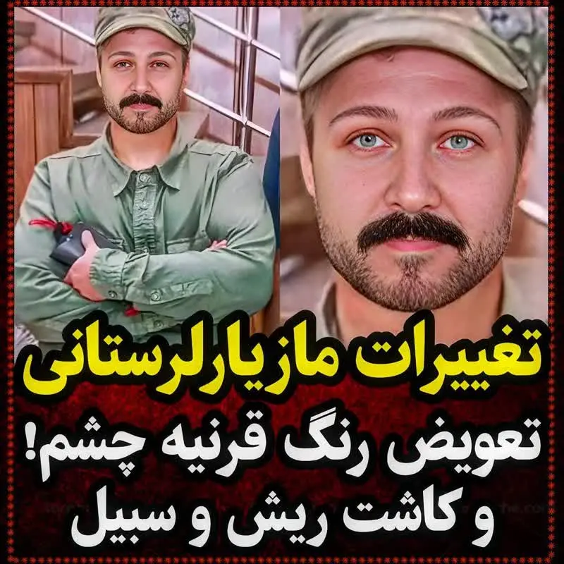 مازیار لرستانی سیبل کاشت | تغییرات مردانه مازیار لرستانی راببینید | مازیار کاملا مرد شده است 2