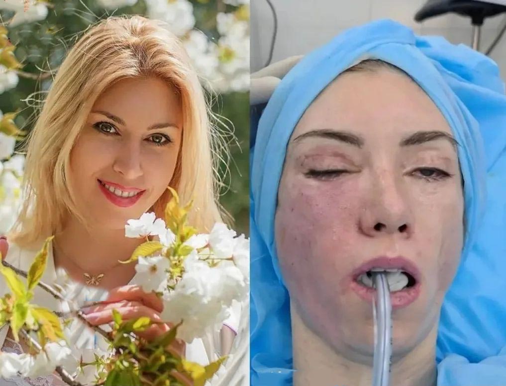 جراحی ملکه زیبایی روس