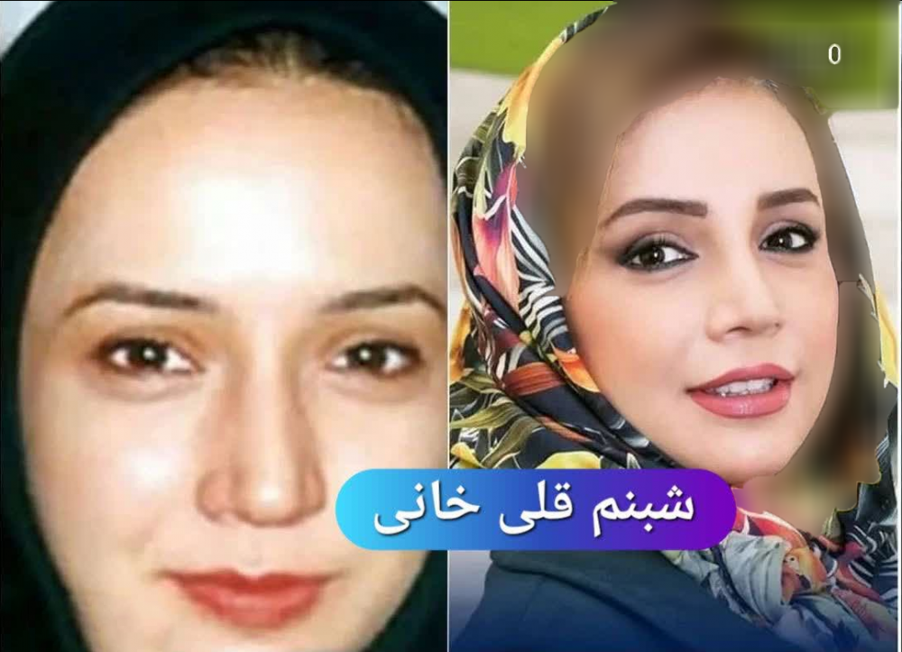 عکس بازیگران زن ایرانی قبل و بعد از عمل زیبایی