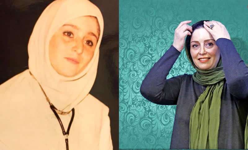عمل زیبایی ژاله صامتی که از این رو به اون رو شده! | قبل و بعد از خانم بازیگر را مقایسه کنید + عکس 2
