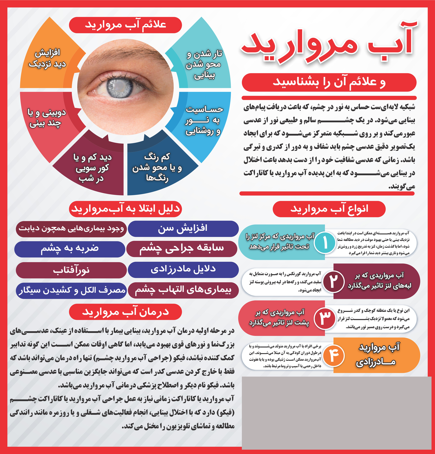 اینفوگرافیک آب مروارید