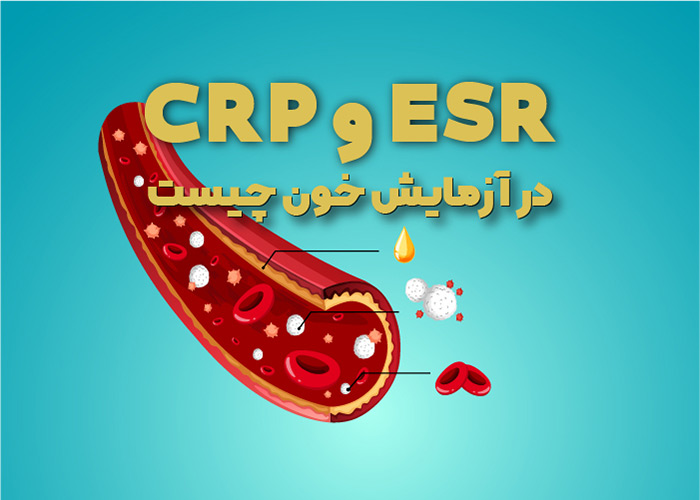 آزمایش ESR