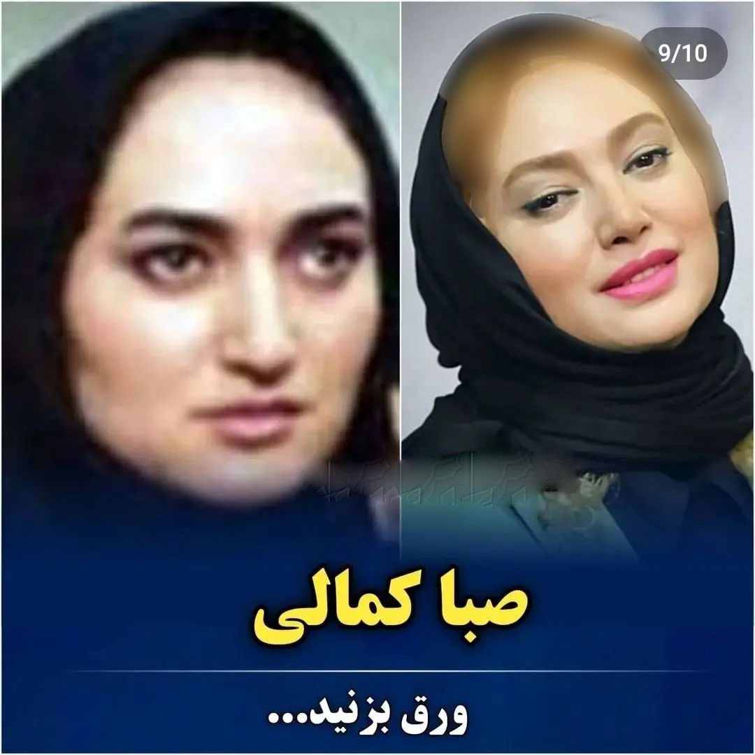 عکس قبل و بعد بازیگران ایرانی (2)