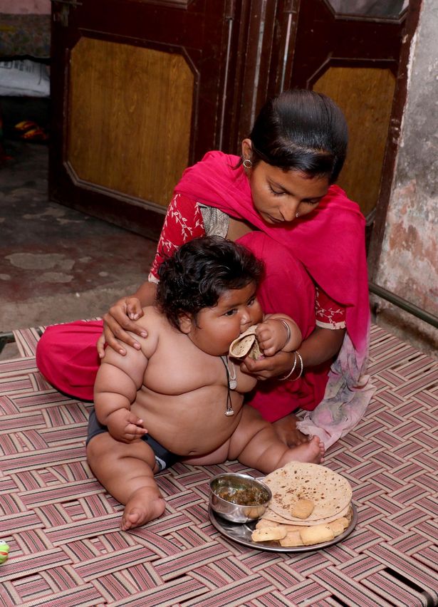وزن گیری بیش از حد دختر بچه هندی