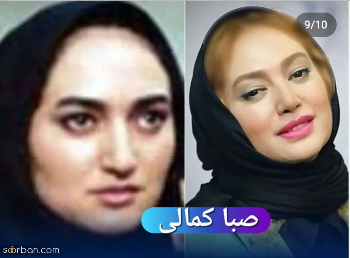عمل زیبایی واژن قبل و بعد