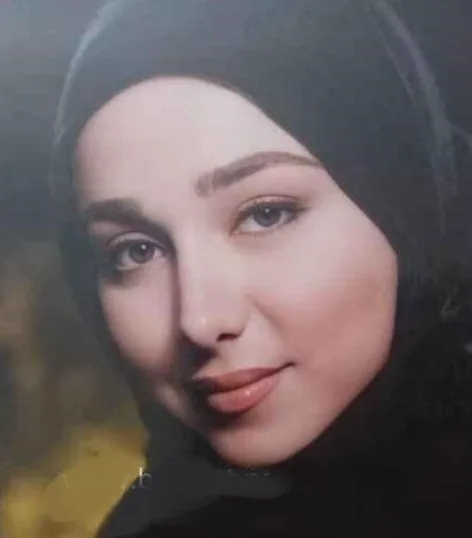 عکس قبل از عمل بینی بهنوش بختیاری