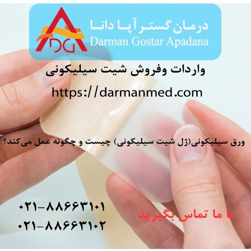 خرید ورق سیلیکونی