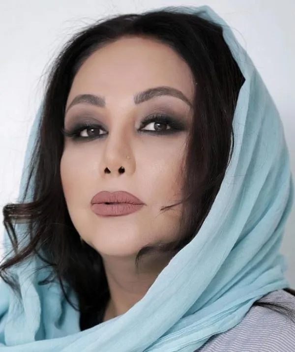 عکس بعد از عمل بینی بهنوش بختیاری