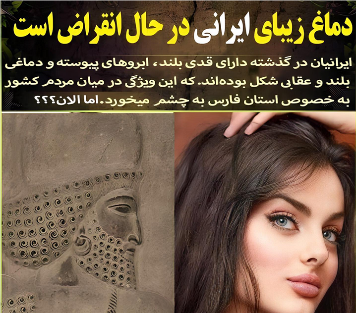 دماغ زیبایی ایرانی در حال انقراض است