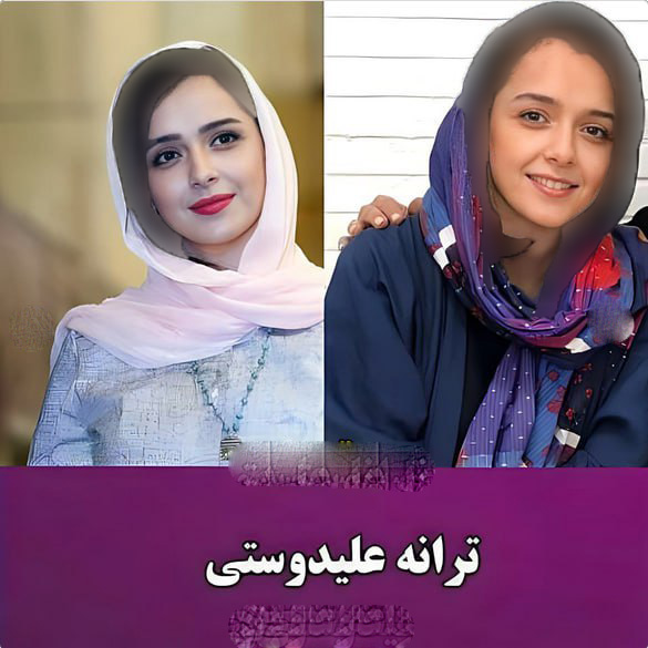 بازیگرانی که جراحی زیبایی نداشتند