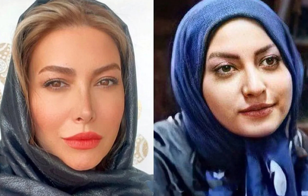 فریبا نادری قبل و بعد از عمل بینی