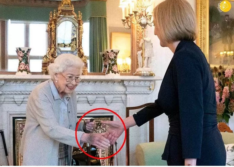 ملکه الیزابت  کبودی دست