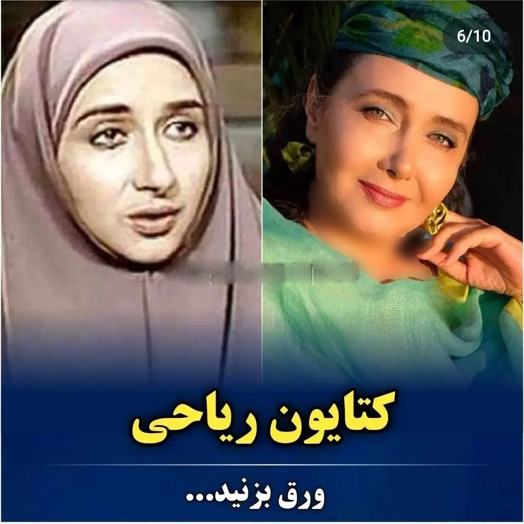 عکس قبل و بعد بازیگران ایرانی (4)