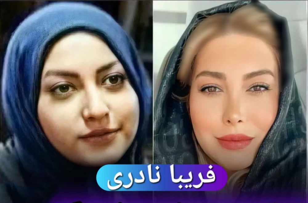 عکس بازیگران زن ایرانی قبل و بعد از عمل زیبایی