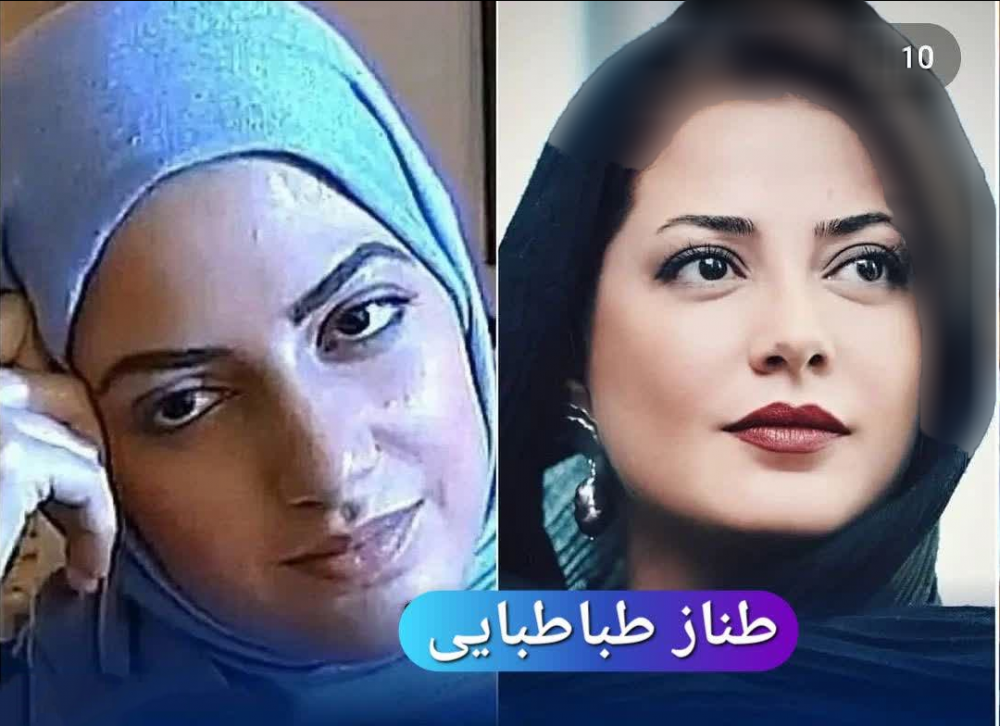 عکس‌های 8 خانم بازیگر ایرانی قبل و بعد از عمل