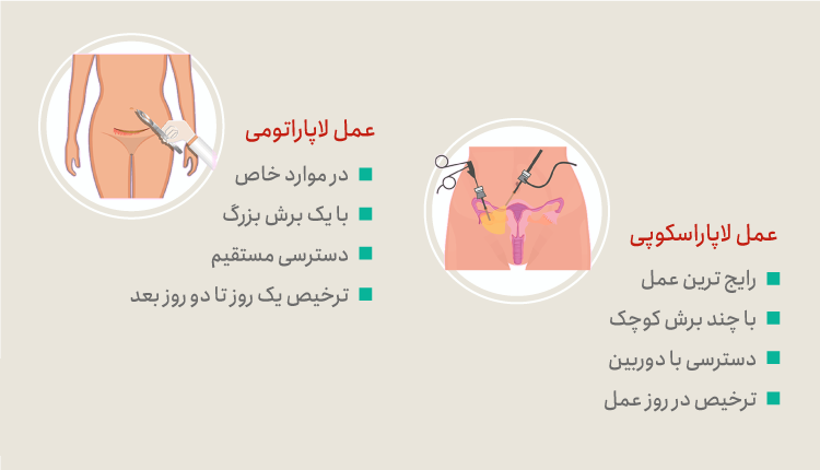 عمل لاپاراسکوپی رحم