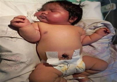 سنگین وزن ترین نوزاد در مشهد 