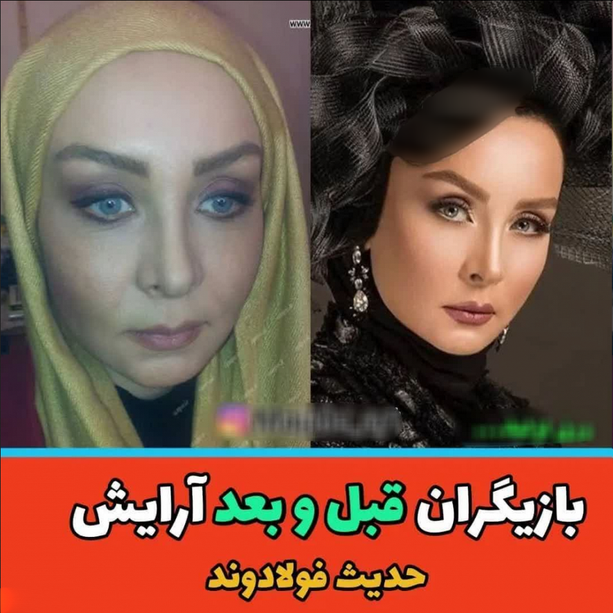 بازیگران قبل و بعد آرایش