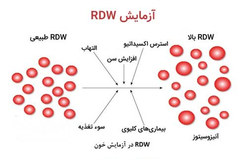 آزمایش RDW