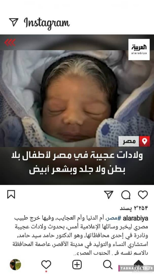 نوزاد عجیب در مصر