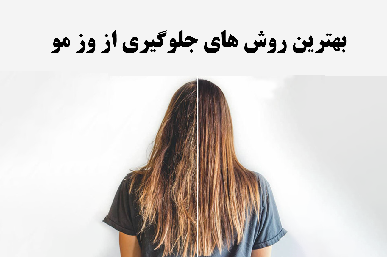 بهترین محصول برای از بین بردن وز مو