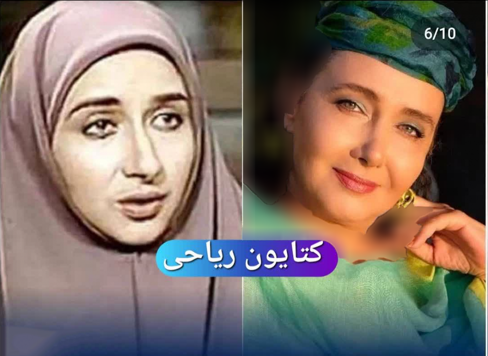 عکس‌های 8 خانم بازیگر ایرانی قبل و بعد از عمل