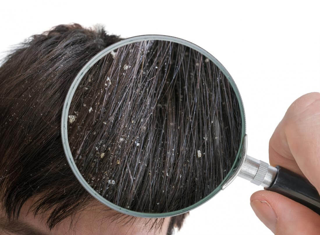 ​۳. مراقبت از مو