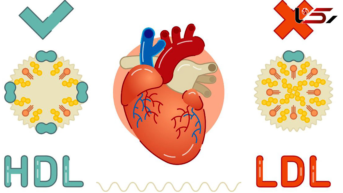 ال دی ال (LDL ) در آزمایش خون چیست؟ / جدول راهنمای سطح ال دی ال خون