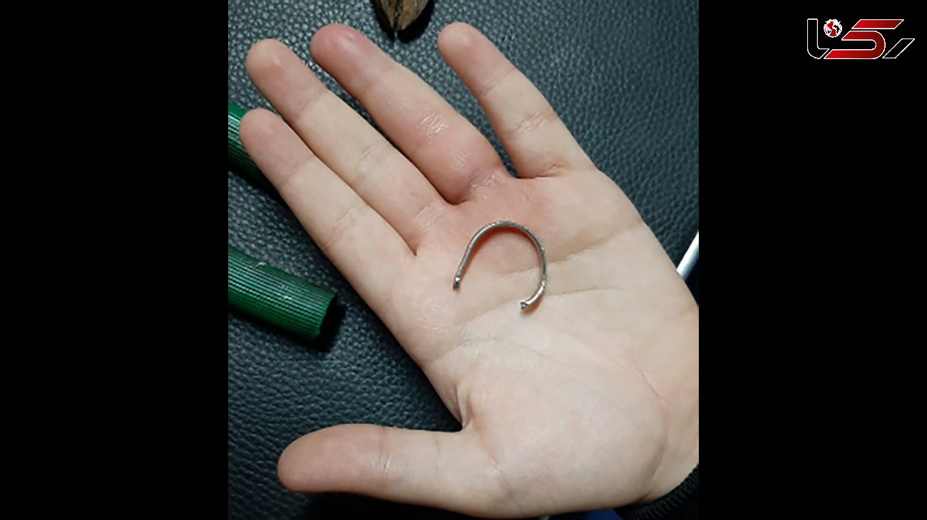 دردسر انگشتر برای دختر 11 ساله اهوازی / آتش نشانان دست به کار شدند + عکس

