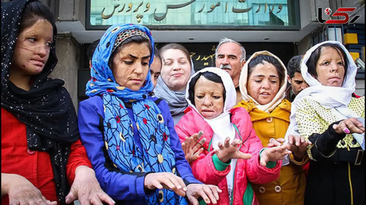 عکس های جگرسوز 13 سال قبل تاکنون / پوست دختران شین‌آبادی در مدرسه سوخت و دلشان در دوران داشنجویی  در دانشگاه /  درمان ما قطع شده است 