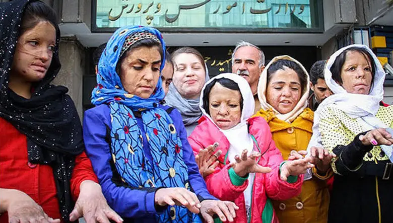 عکس های جگرسوز 13 سال قبل تاکنون / پوست دختران شین‌آبادی در مدرسه سوخت و دلشان در دوران داشنجویی  در دانشگاه /  درمان ما قطع شده است و ...