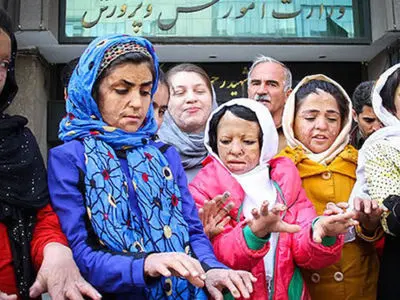 عکس های جگرسوز 13 سال قبل تاکنون / پوست دختران شین‌آبادی در مدرسه سوخت و دلشان در دوران داشنجویی  در دانشگاه /  درمان ما قطع شده است و ...