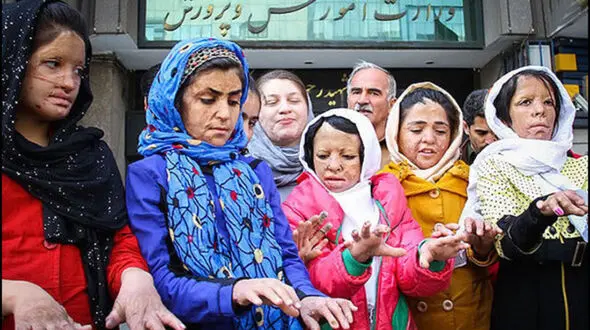 عکس های جگرسوز 13 سال قبل تاکنون / پوست دختران شین‌آبادی در مدرسه سوخت و دلشان در دوران داشنجویی  در دانشگاه /  درمان ما قطع شده است 