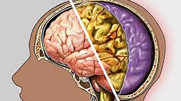جوانسازی مغز با چند ورزش ساده