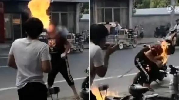 آتشخواری یک نوجوان او را از قیافه انداخت +فیلم