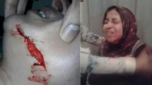 بلای کثیفی که پسر دانش آموز به سر خانم معلم  آورد + عکس 