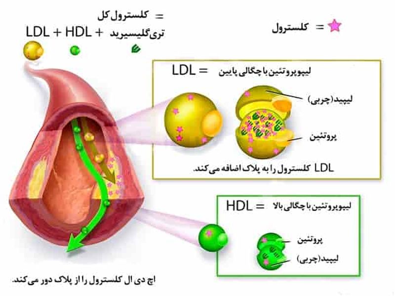 اچ دی ال