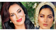تغییر باورنکردنی خانم بازیگر معروف ترکیه ای با عمل زیبایی + عکس قبل و بعد عمل