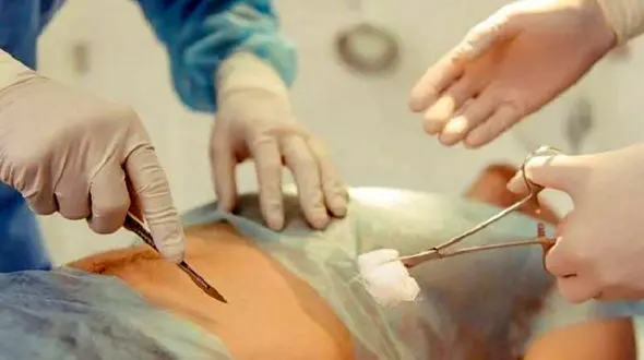 عفونت آپاندیس چه علائمی دارد؟