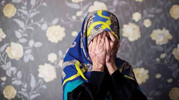 اسیدپاشی وحشتناک به کسانی که در ایستگاه اتوبوس به صف بودند! / اسیدسوخته ها چه گفتند؟!