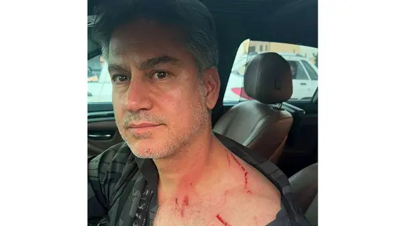 عکس خفتگیری از مربی تیم ملی فوتبال / جزئیات حمله دزدان موتورسوار به حمید مطهری