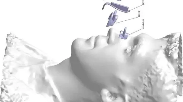 شایع ترین سن جراحی زیبایی بینی