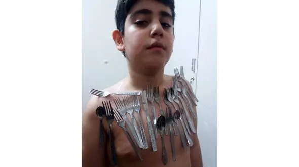 پسر آهن‌ربایی در اصفهان + عکس