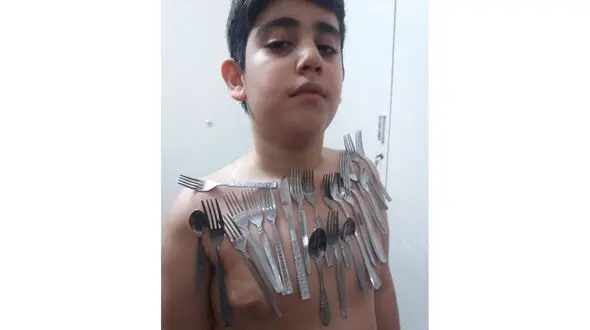 پسر آهن‌ربایی در اصفهان + عکس