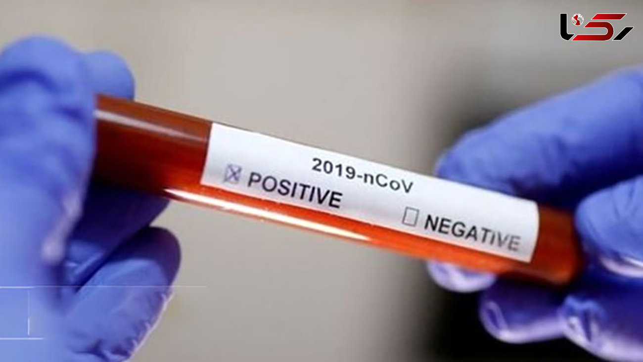 شناسایی ۸ مورد جدید ابتلا به کروناویروس در فارس/ شمار مبتلایان به ۲۸ نفر رسید