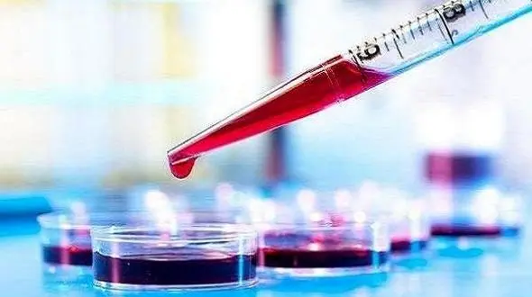 تشخیص آلزایمر با یک آزمایش خون ساده