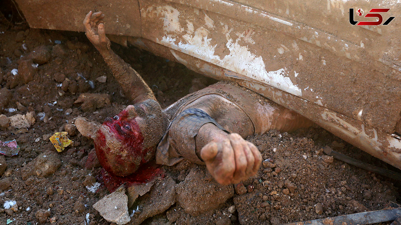 تصاویر باورنکردنی / زنده ماندن معجزه آسای مرد لبنانی در خاک و خون انفجار بیروت