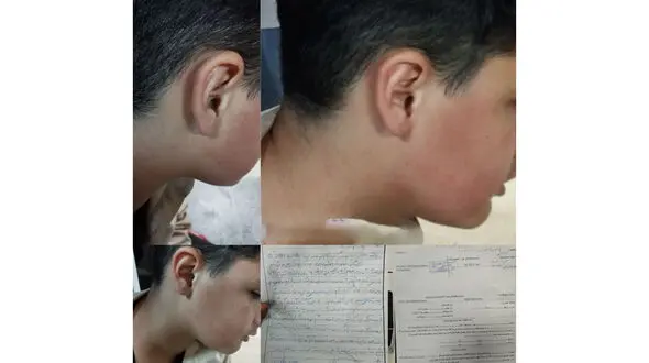 برخـورد قانونی با معــلـم خاطـی در لاهیجـــان + عکس دانش آموزی که کتک خورده بود!