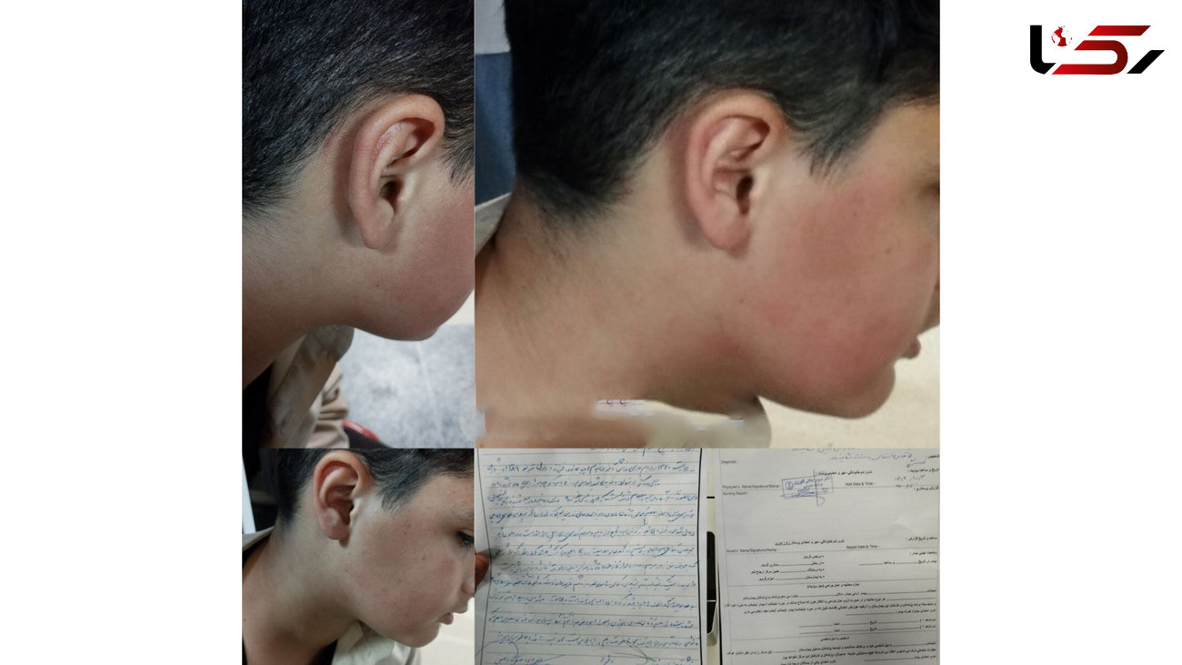 برخـورد قانونی با معــلـم خاطـی در لاهیجـــان + عکس دانش آموزی که کتک خورده بود!